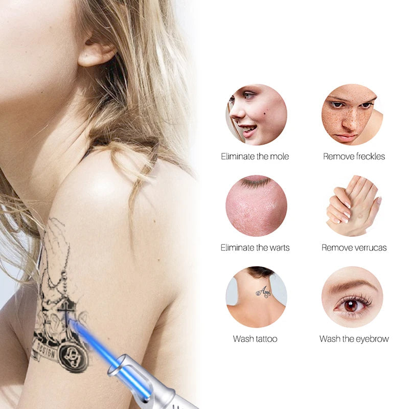 Laser Pen for Tattoo, Mole, and Freckle Removal