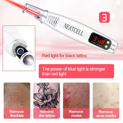 Laser Pen for Tattoo, Mole, and Freckle Removal