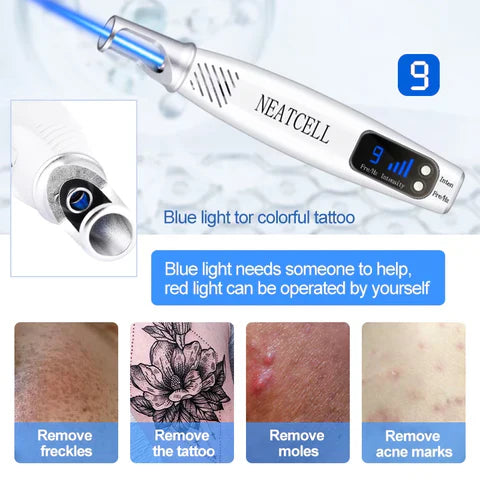 Laser Pen for Tattoo, Mole, and Freckle Removal