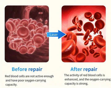 Smartwatch for Blood Sugar Monitoring