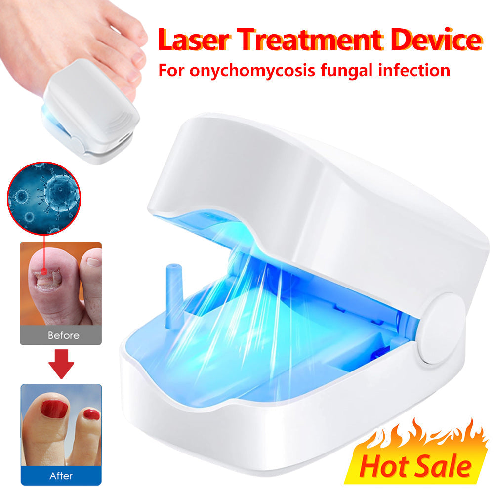 At-Home Laser Device for Toenail Fungus Treatment